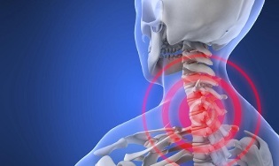 vzroki za osteohondrozo materničnega vratu