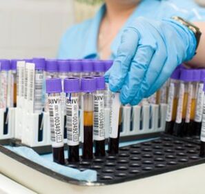 krvni test za diagnosticiranje bolečine v sklepih