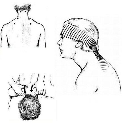 mišične bolečine v vratu in masaža za lajšanje bolečin