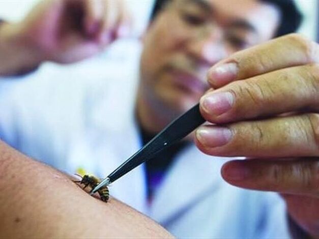 apiterapija za cervikalno osteohondrozo